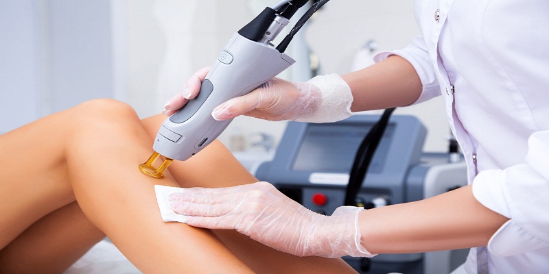 What To Do Before Laser Hair Removal Treatment?